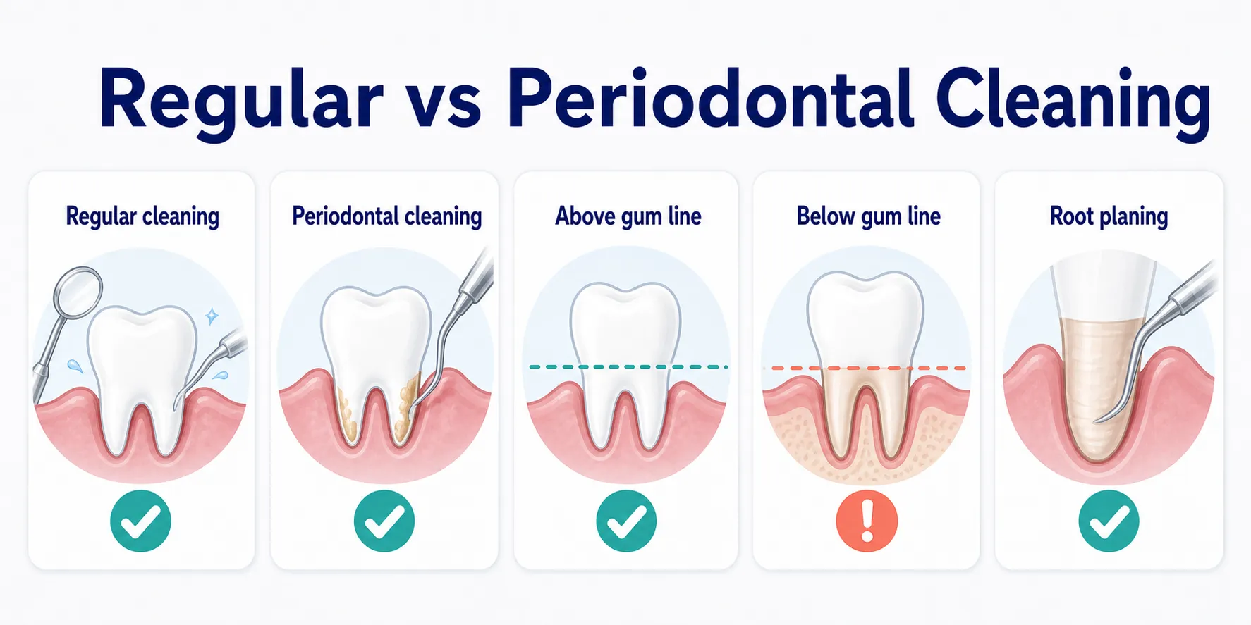 What's the Difference Between a Periodontal Cleaning and Regular Cleaning comparison board covering Regular cleaning, Periodontal cleaning, Above gum line, Below gum line, Root planing