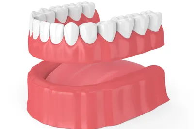 How Much Do Dentures Cost?