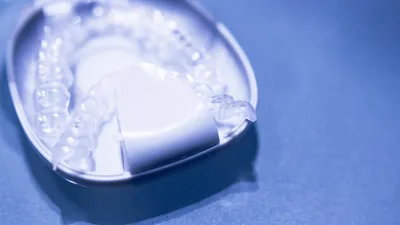 Invisalign Canada Review