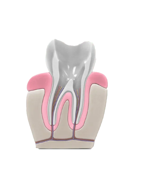 Root canal procedure step2 1