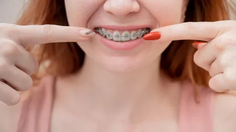 5 Alternatives to Braces