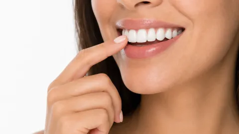 Snap-On Smiles: How They Work & Costs