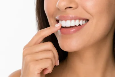 Snap-On Smiles: How They Work & Costs