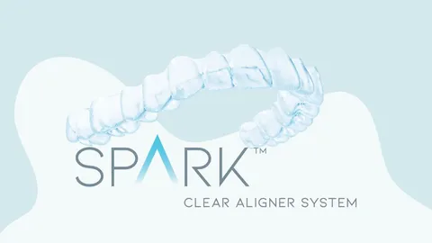 Spark Aligners Review (2026)