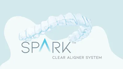 Spark Aligners Review (2026)