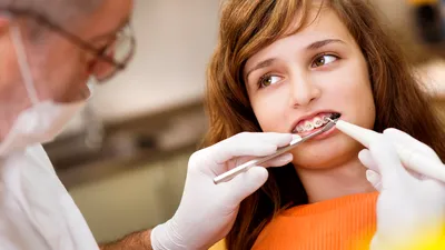 5 Ways to Fix a Snaggle Tooth