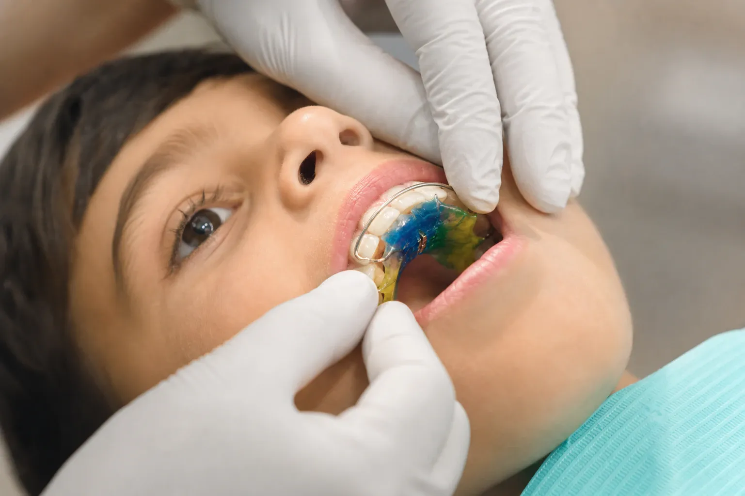 The boy with his mouth open lies in the dentists chair while the nm 1237