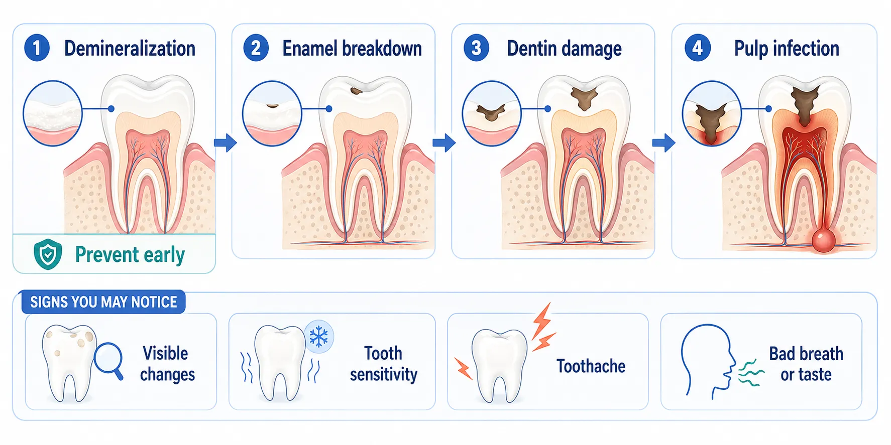 Tooth decay signs board v1