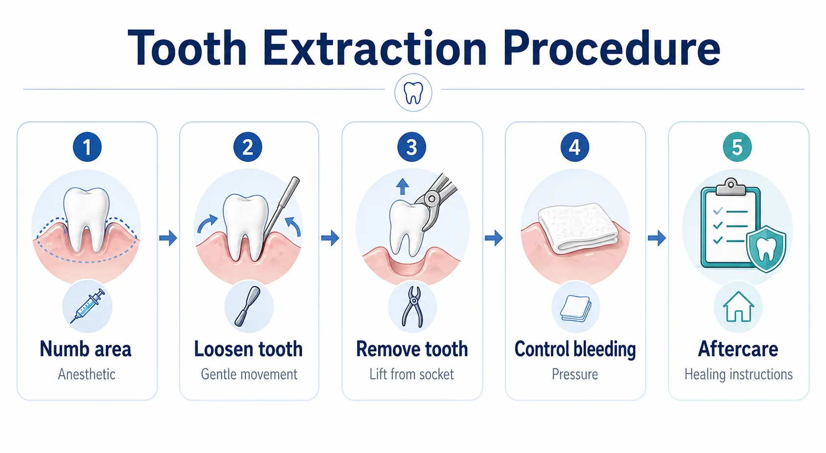Tooth extraction procedure workflow v1
