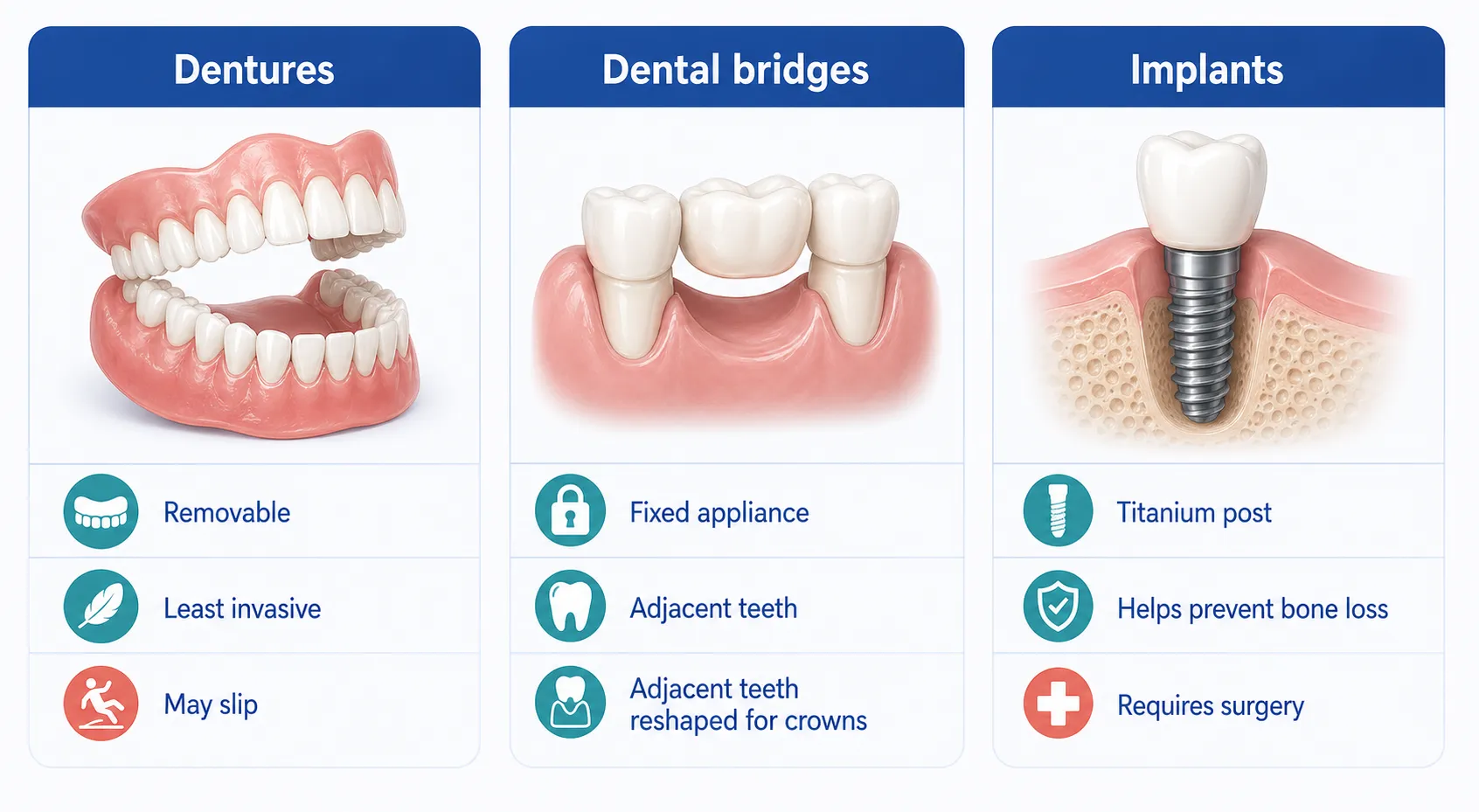 Tooth replacement options comparison v1