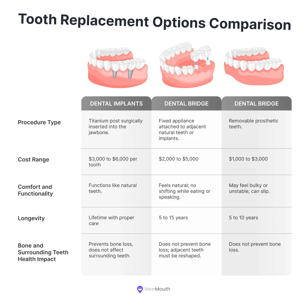 Tooth replacement options comparison
