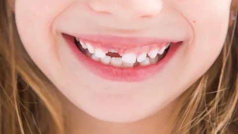 When Do Kids Start Losing Teeth?