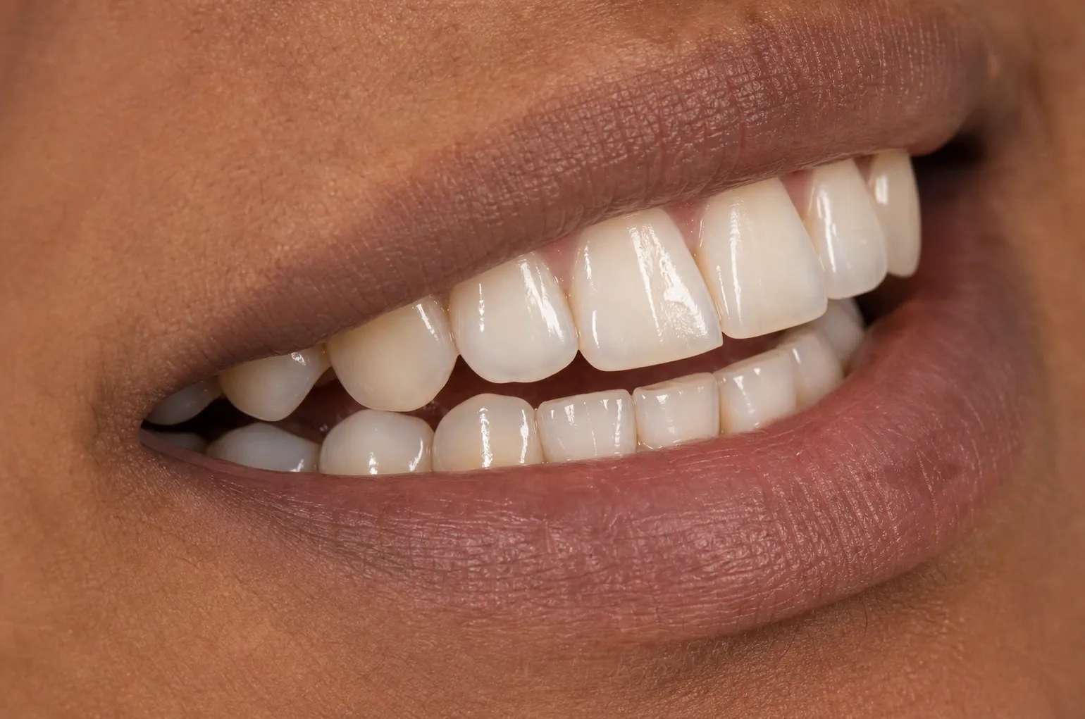 Translucent teeth medical image 2 nm 1314