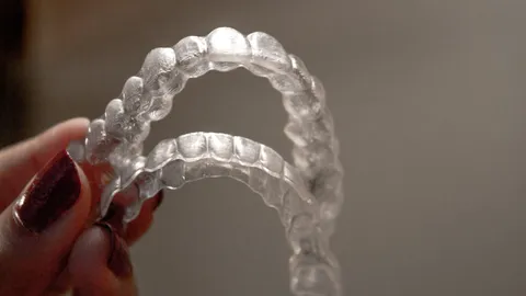 Can Invisalign Fix an Overjet?