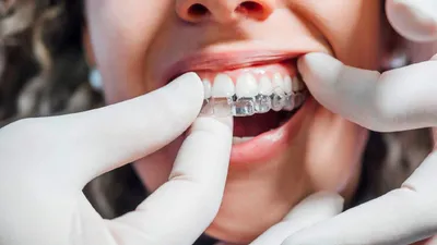 Does Invisalign Treatment Hurt?