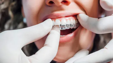 Does Invisalign Treatment Hurt?