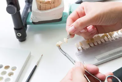 What to Know Before Getting Porcelain Veneers