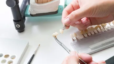 What to Know Before Getting Porcelain Veneers