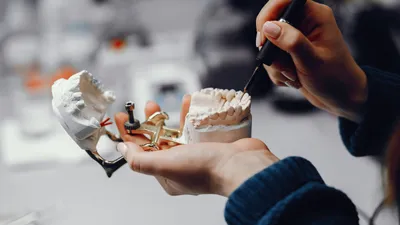 Implant Supported Dentures