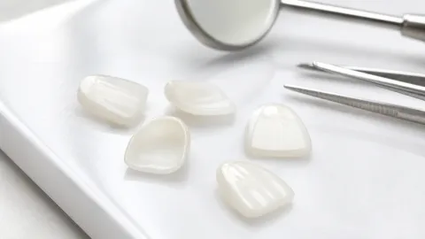Are Veneers Covered by Insurance?