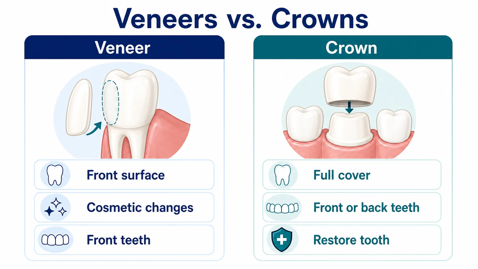 What's the Difference Between Veneers and Crowns? comparison board