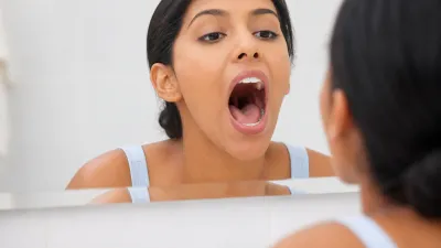 Bumps on the Back of Your Tongue: Causes and When to Worry