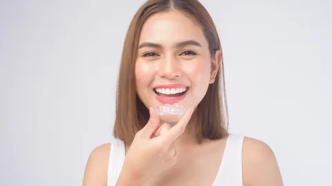 Vivera (Invisalign)