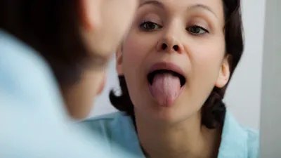 Why Is My Tongue Itchy?