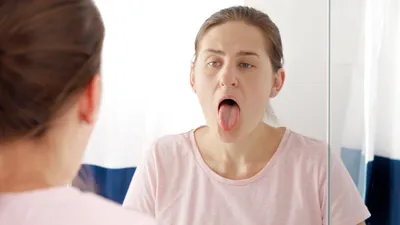 What Are the Causes and Treatments for Scalloped Tongue?