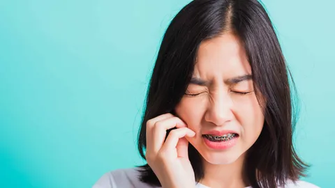 Why Do My Gums Swell With Braces?