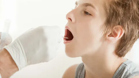 Trench Mouth Symptoms, Causes & Treatment