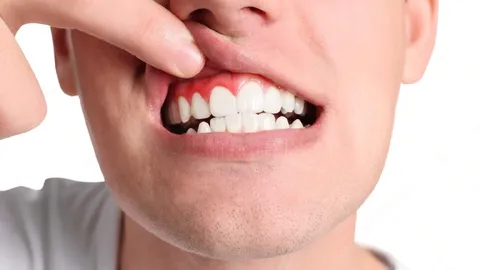 Receding Gums: Causes, Treatment, and More