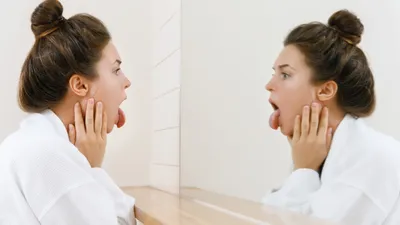 Yellow Tongue: Causes, Treatments, & When to See a Doctor