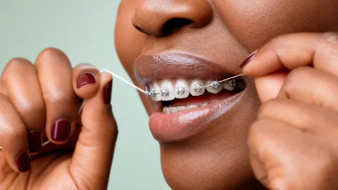 How to Floss With Braces (Step-by-Step)