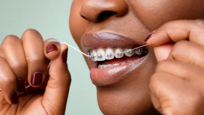 How to Floss With Braces (Step-by-Step)