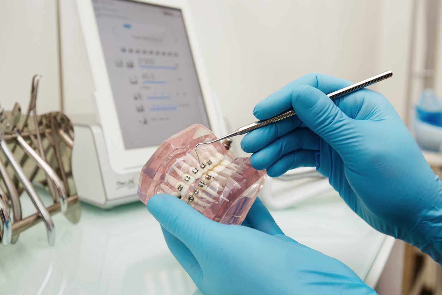 cheapest-ways-to-straighten-your-teeth-braces-aligners