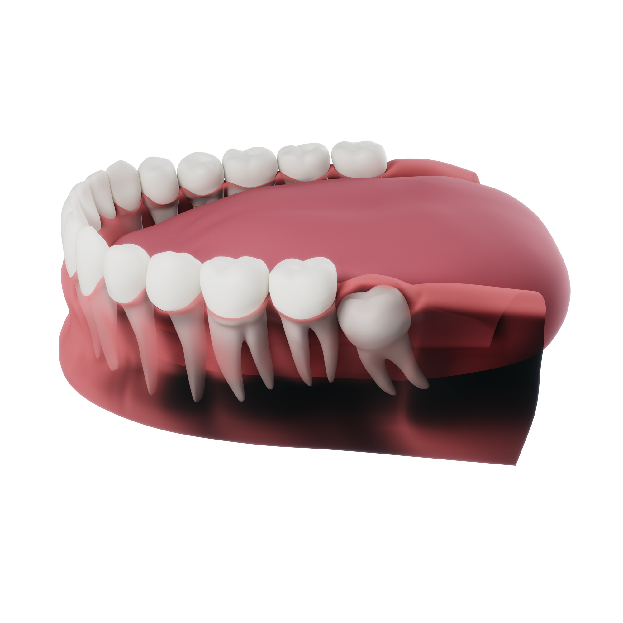How Much Does Wisdom Tooth Removal Cost?