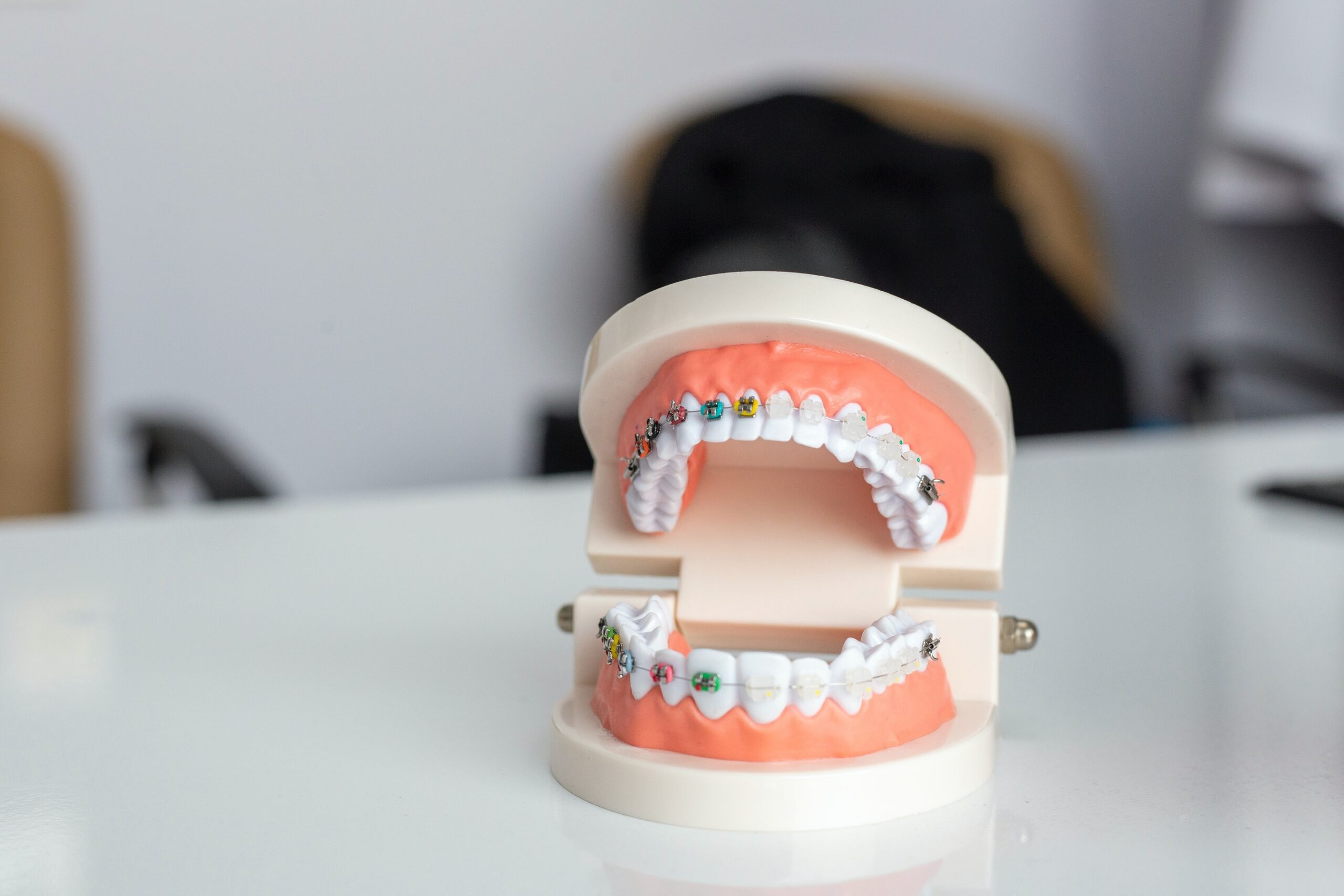 A dental model with orthodontic braces showing upper and lower teeth on a white surface.
